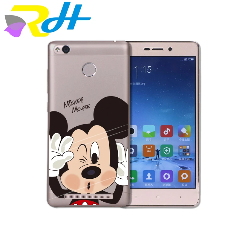 Чехол из ТПУ для Xiaomi Redmi 4A 4X Note 5A Mi 5X 6 Plus чехол с наклейками на рот и поцелуй 4 |