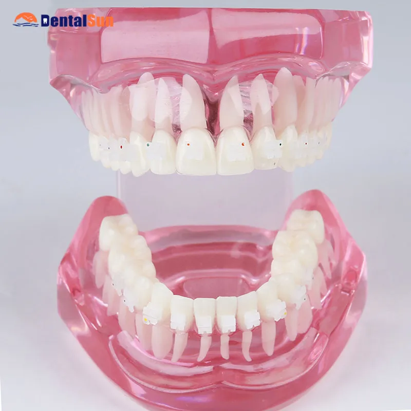 

Dental Demonstration Model/M6002 Overdenture Inferior model with 2 implant