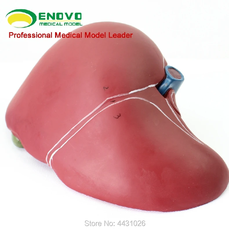 

ENOVO The liver model of the hepatic cholecystogram of the human hepatic gallbladder is digested by the liver model