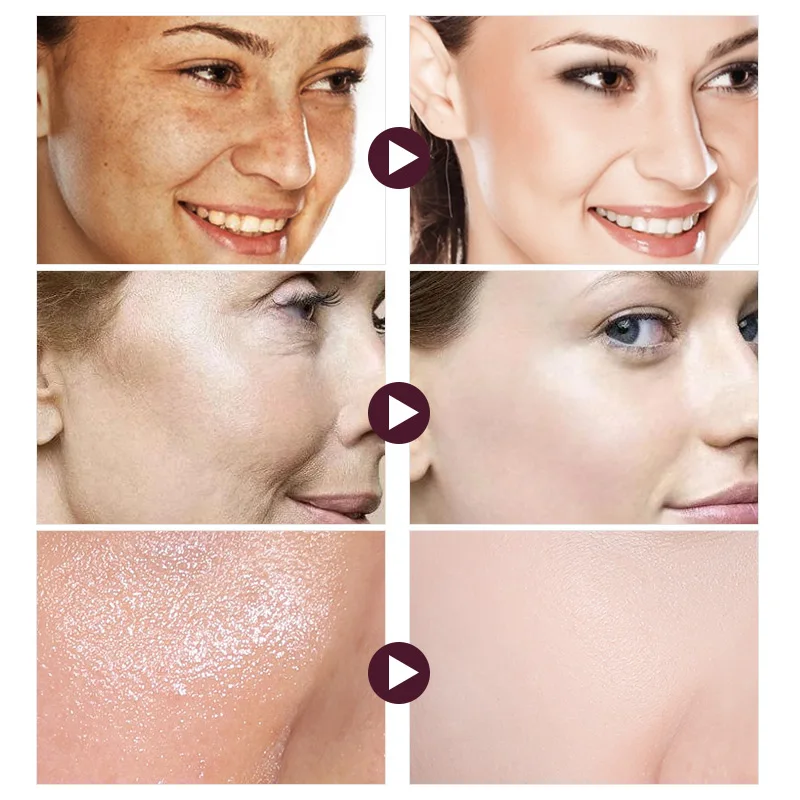 5 шт. красный женьшень уход за кожей лица набор тонера/лосьон/дневной