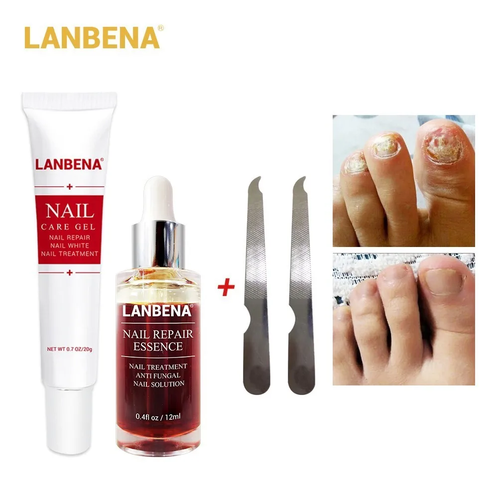 LANBENA из 2 предметов по уходу за ногтями гель для ремонта + крем эссенция ручная
