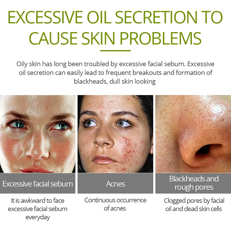 Крем от акне Tea Tree средство для снятия крема и удаления ухода за кожей лица