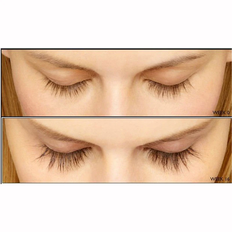 Feg лечение роста ресниц усилитель сыворотка натуральная травяная медицина