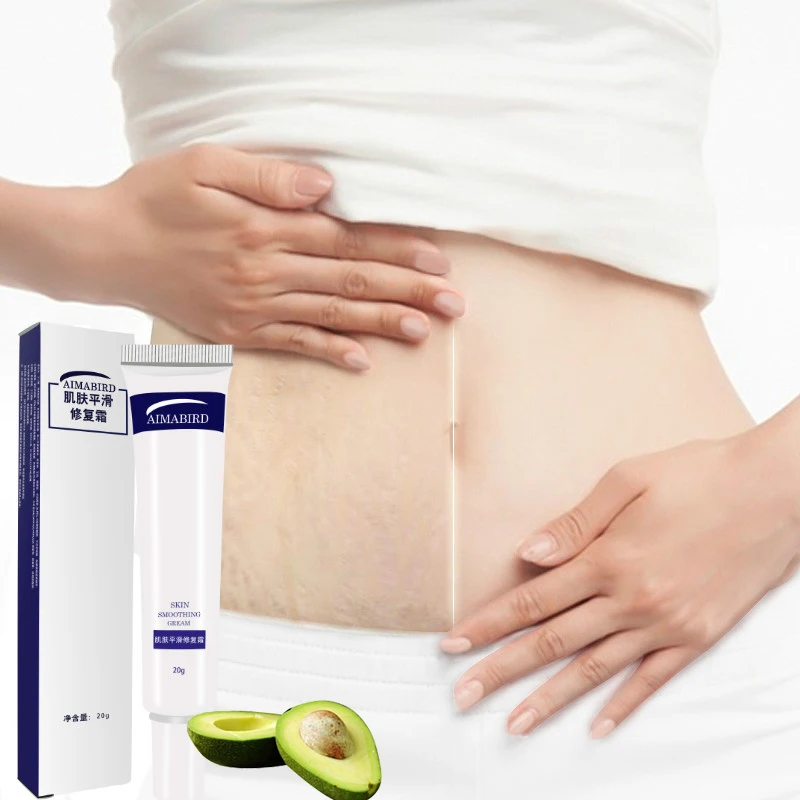 Pregnant Skin Body Cream Stretch Marks Smooth Skin Cream Remover Maternity Removal Powerful Postpartum Obesity Pregnancy Cream