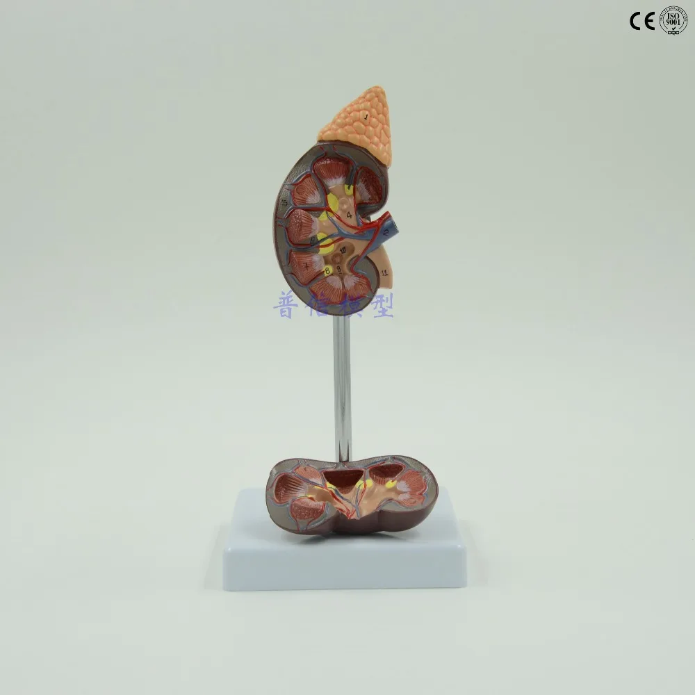 

Human kidney anatomical model urinary system Medical Science teaching supplies