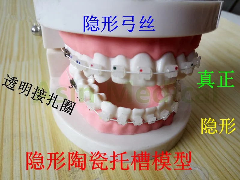 

Good Quality Dental materials Orthodontic stealth teaching practice ceramic brackets correction model teeth model