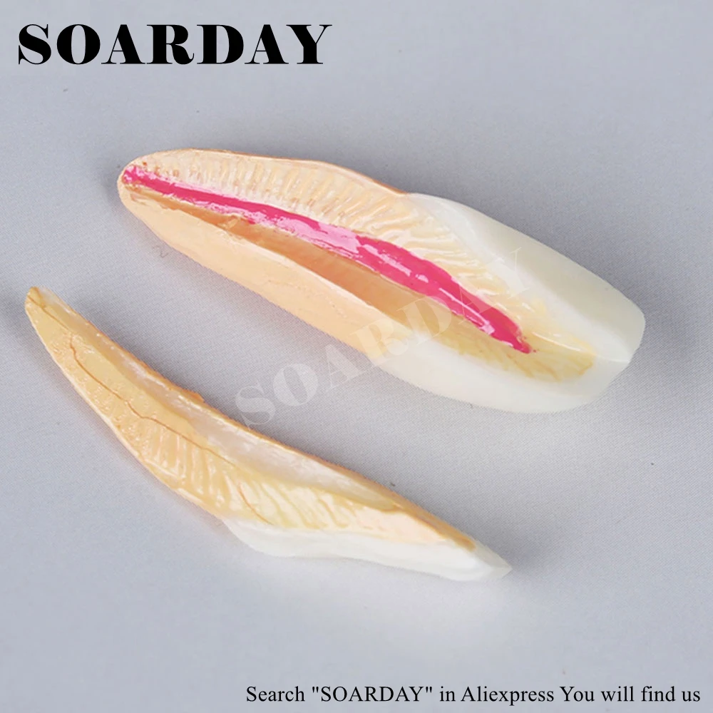 SOARDAY эндодонтическая реставрация модель обучения практики стоматолога пациента