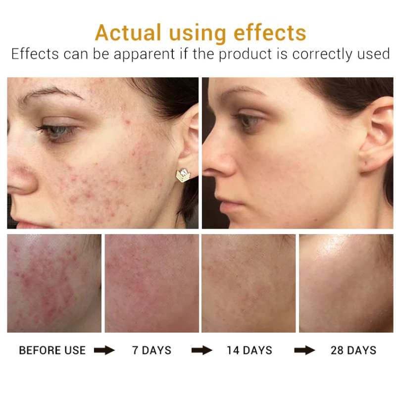 

BREYLEE Snail Face Serum Collagen Serum Repairing Essence Hyaluronic Acid Moisturizing Anti-aging Whitening Facial Skin Care