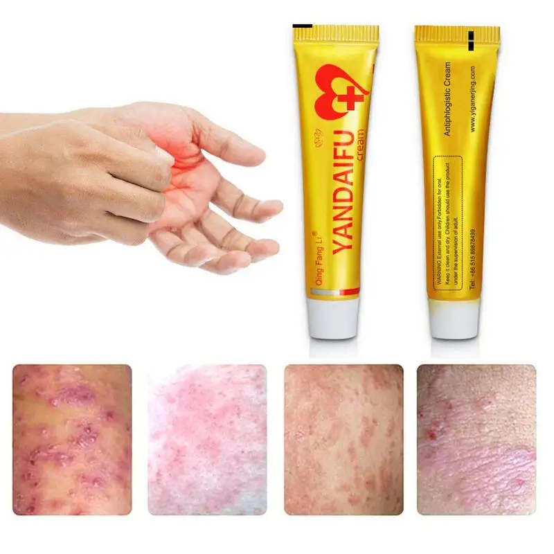 60pcs Wholesale Yandaifu Original Psoriasis Dermatitis Eczema Pruritus Skin Problems Cream Analgesic Arthritis Cream WITH BOX