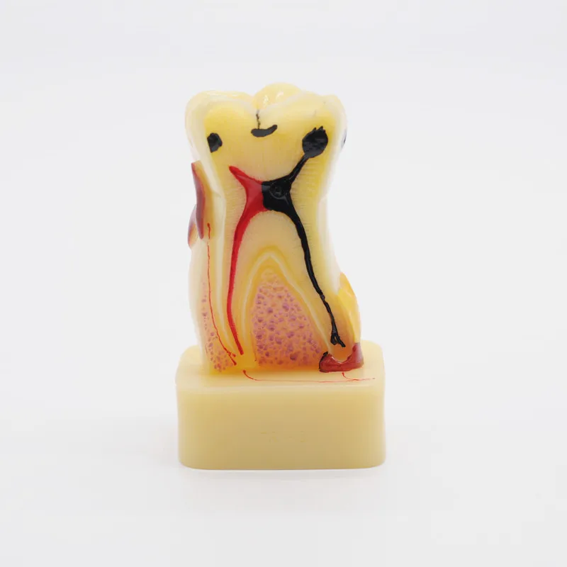 Стоматологическое лабораторное оборудование обучение модель зубных