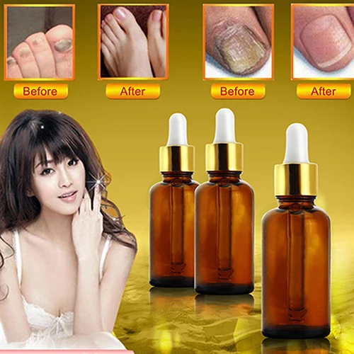 2016 Новый Палец ноги Ремонт Сущность Жидкость Грибок Ногтей Онихомикоз Удаления