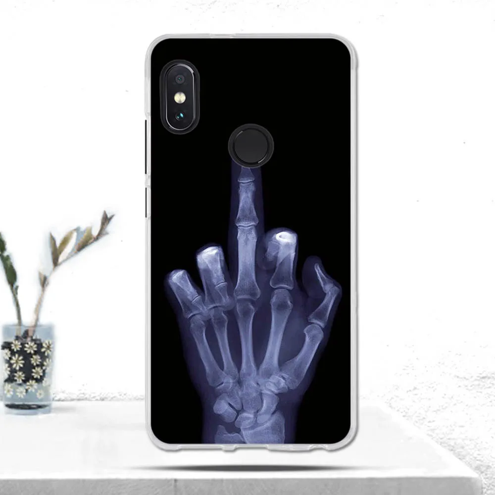 Для Xiaomi Redmi Note 5 Pro/Redmi (Китай) чехол мягкий TPU силиконовый для телефона Pro Чехол