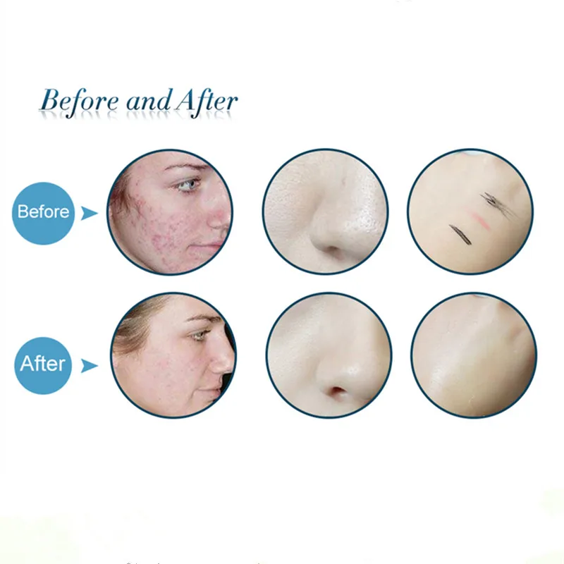 Органическое мыло ручной работы из натуральной черники Отбеливающее эфирное