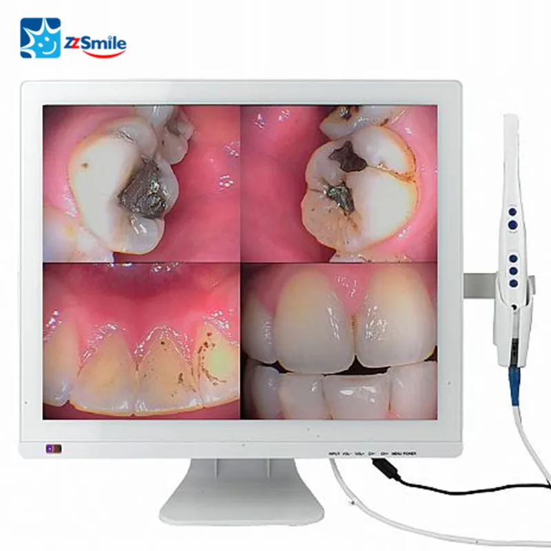 

CE/FDA Approved M-978V Dental Intraoral System With Self-contained 17inch LED Monitor