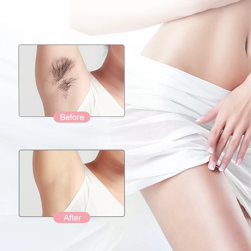 Аппарат для безболезненного удаления волос IPL лазером мини электрический