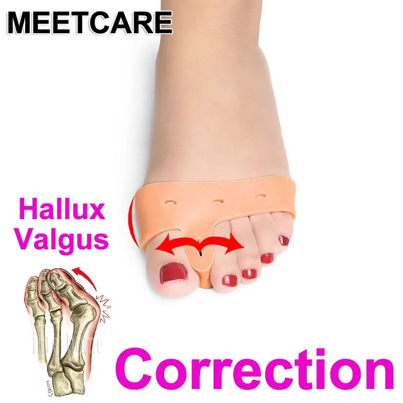 9 шт. большой палец носок вальгусная деформация Ортез Bunion коррекция шина для
