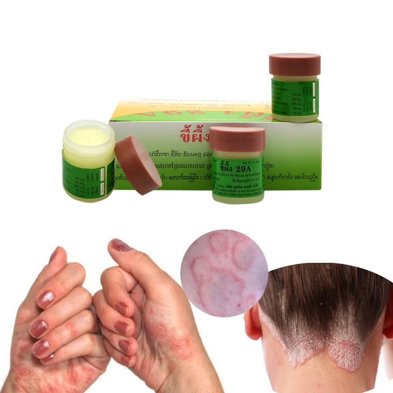 12 шт./кор. крем для лечения псориаза Eczma идеально подходит все виды кожи проблем с