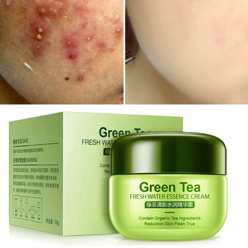 ROREC зеленый чай акне крем против Гиалуроновая кислота Отбеливающее средство для