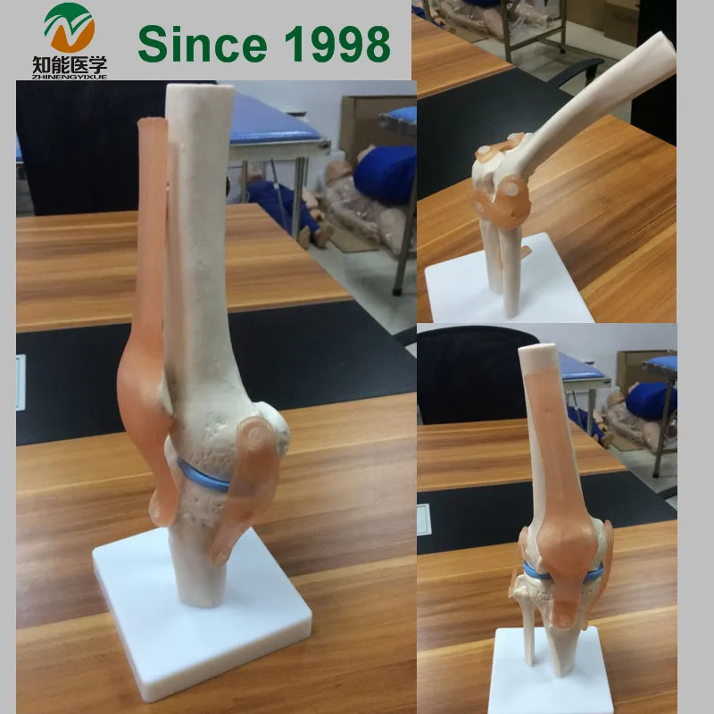 BIX A1019 колено медицинская Учебная модель WBW210|medical teaching model|medical modelknee model |