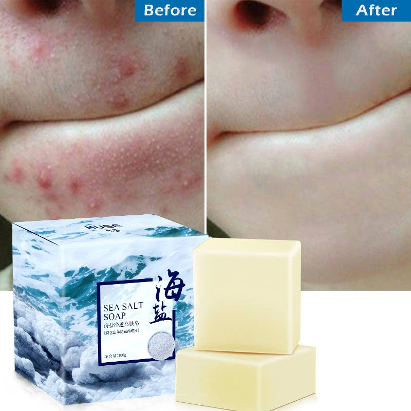 Морская соль мыло прыщи лечение акне Коза увлажняющее молочко для лица очищающее