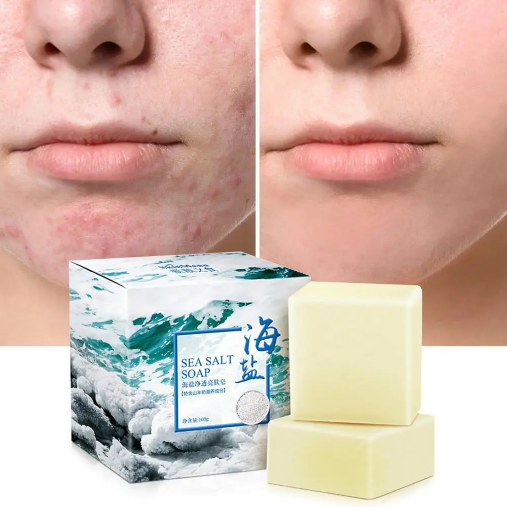 100 г мыло ручной работы для удаления морской соли прыщи поры лечение акне