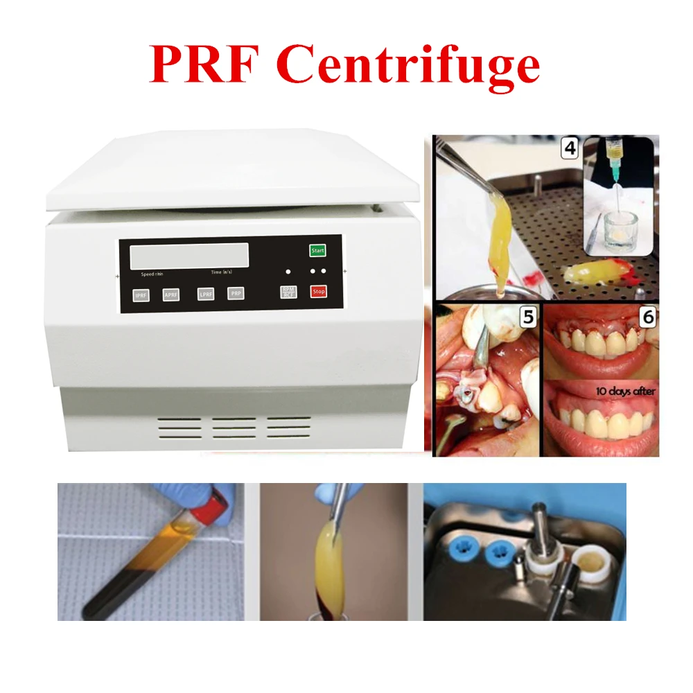 IPRF APRF LPRF PRP центрифуги подходят для 10 мл трубка prf 8 мл PRP трубка для стоматологических, пластических хирургии, клиник, использования сыворотки крови и т. Д