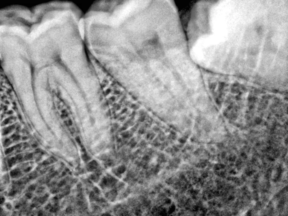 Manka Care - Sanso I Dental Digital USD рентгеновский Датчик Сканнер CMOS/рентгеновский s/не