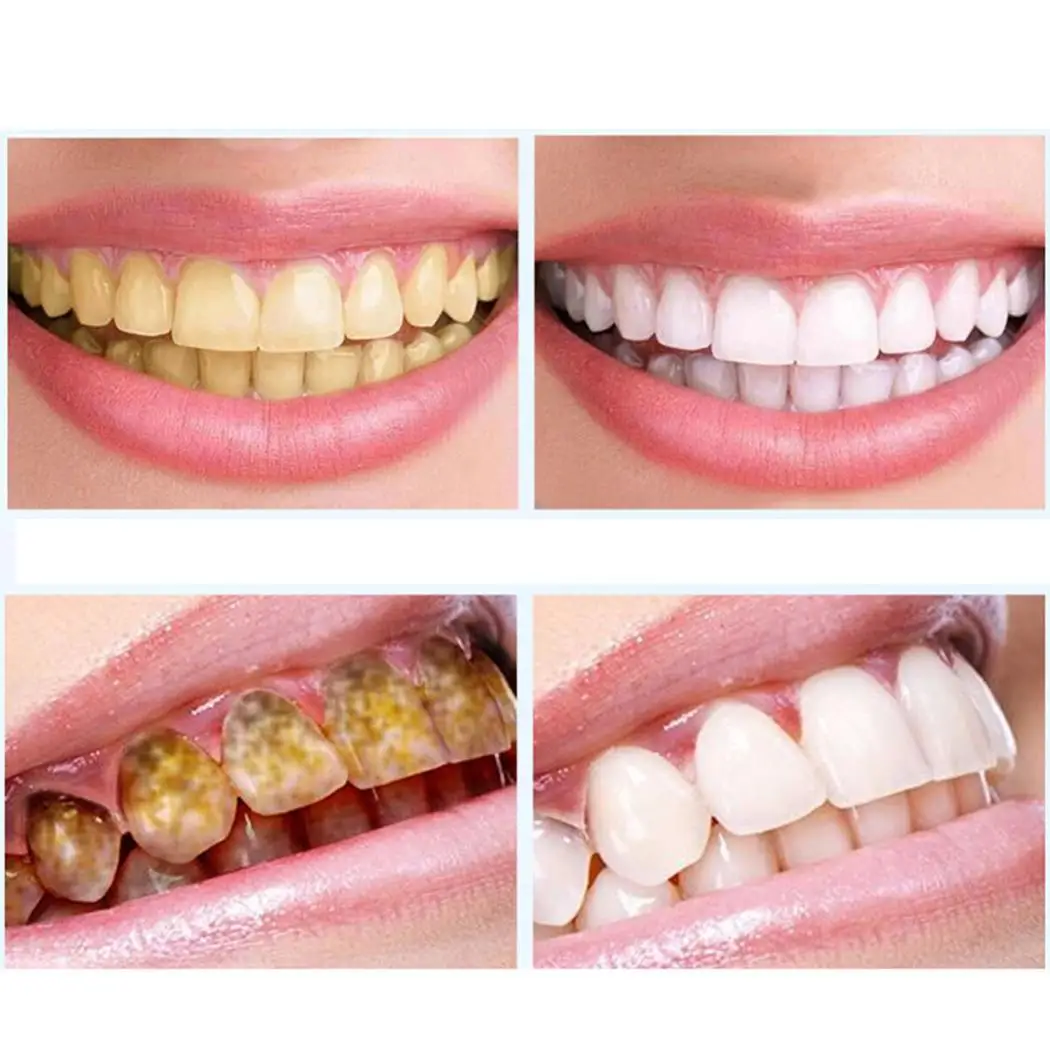 Практичная мягкая Очистка зубов удаление пятен как изображение домашнего