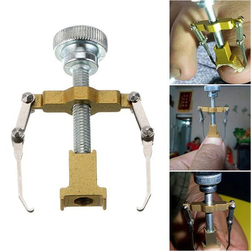 Nail Aligner Ingrown Toe Recover Correction Pedicure Tool Gold Silver Color Metal Foot Fixer Art Design Care Tools | Красота и