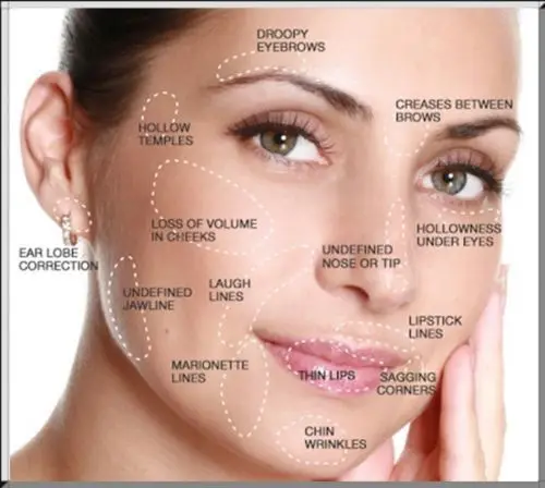 Hyaluronic Acid Liquid 1000g Moisturizing Anti-wrinkle Beauty Products Cosmetics Salon Equipment Supplies