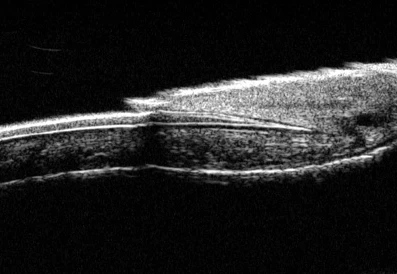 Микроскоп для ультразвуковой биомикроскопии с ультразвуковым