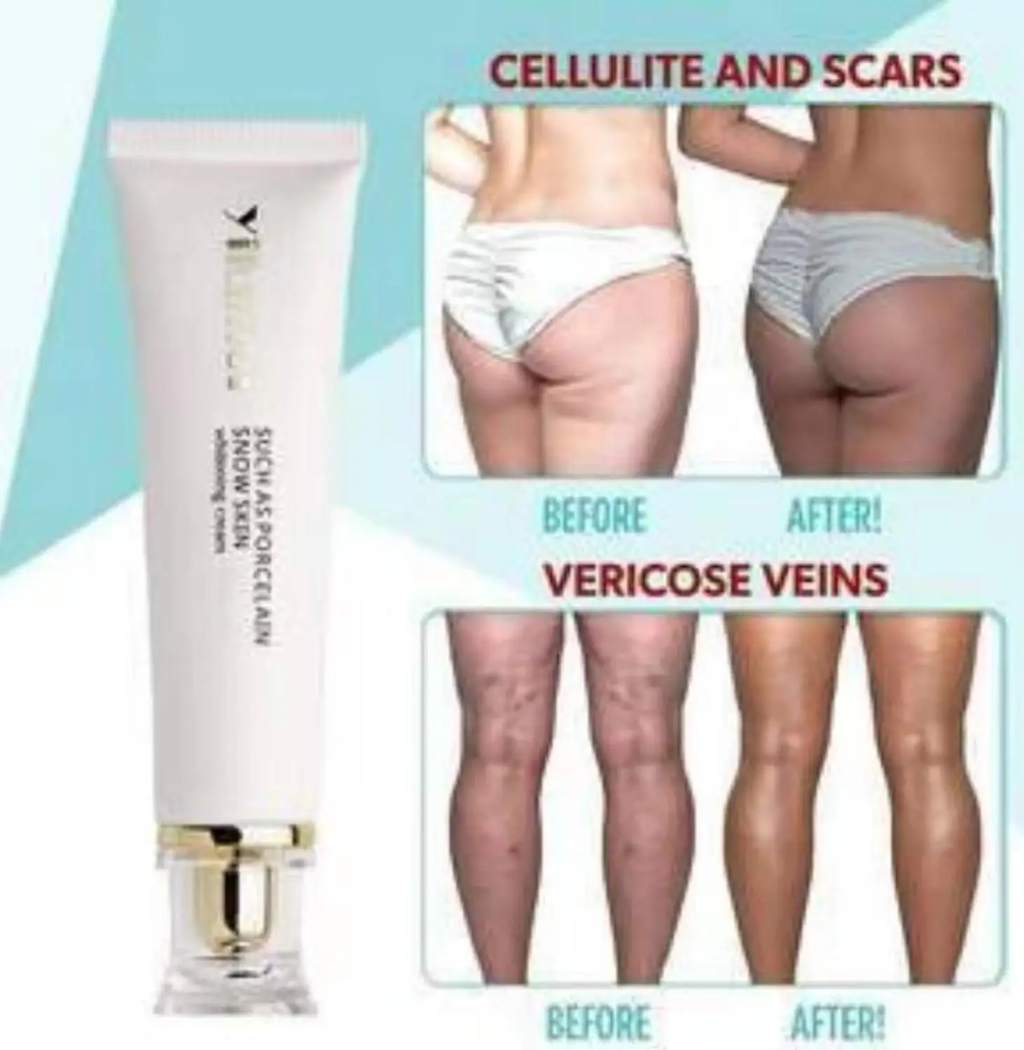 CELLULITE REMOVAL CREAM Remove Scar Cream Firming cream Whitening such as porcelain snow skin beauty essence | Красота и здоровье