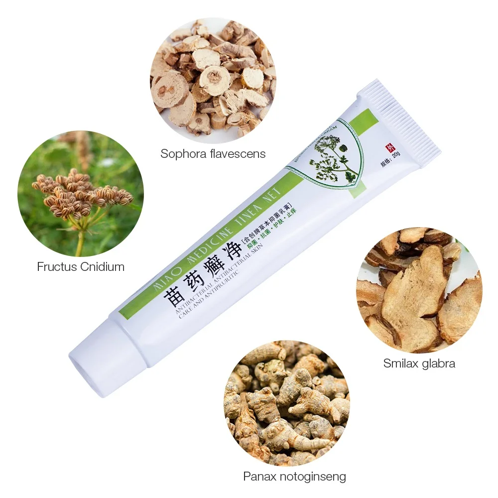 Лидер продаж китайский травяной натуральный крем от псориаза ручной работы мазь