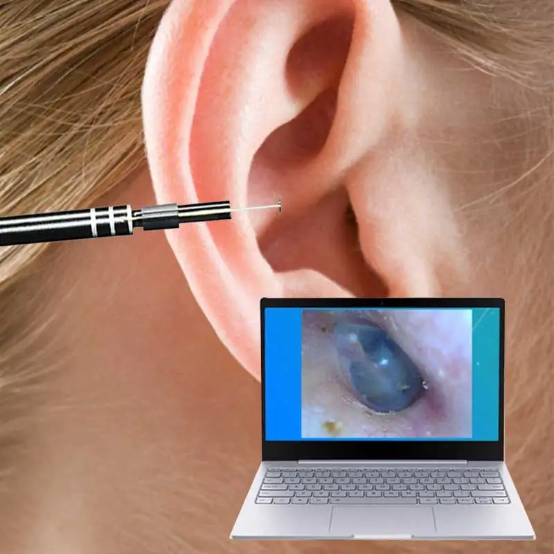 Usb инструмент для очистки ушей многофункциональная ложка HD с мини камерой ручка