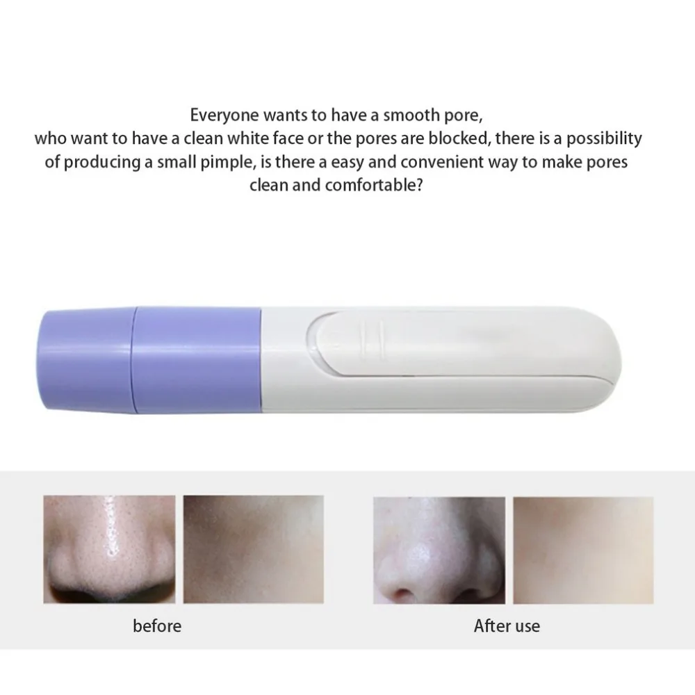 Мини портативный инструмент для удаления черных точек вакуумный экстрактор акне