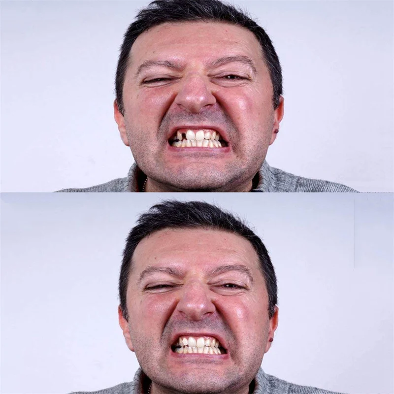 Набор для ремонта зубных протезов набор временного и зазоров твердый клей 2019 |