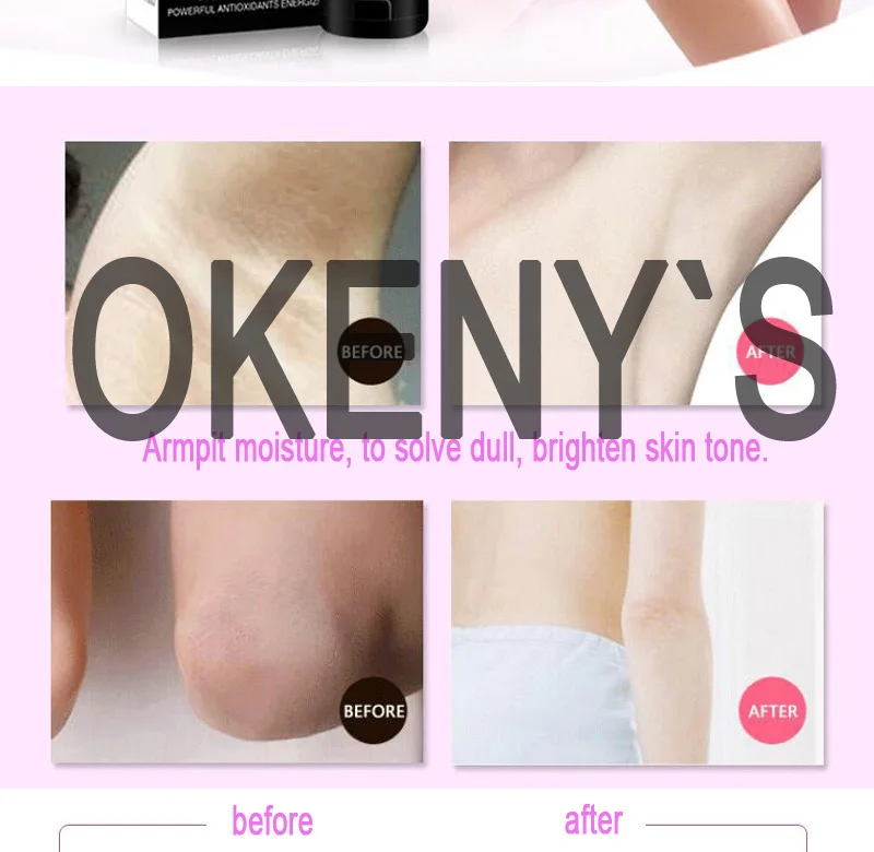 Aichun beauty крем для тела Отбеливание подмышки крем между ног и коленей отдельные части отбеливающая формула отбеливатель подмышек Интимная