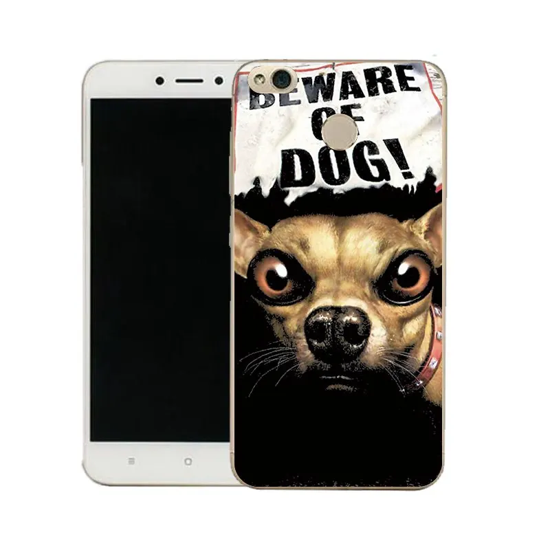 QMSWEI Tpu Clear Phone Case For Mi 6 5 5s note3 Redmi note4x 4x 3s 4a 5a note5a Soft Eagle Red Lips Cover Free shipping |
