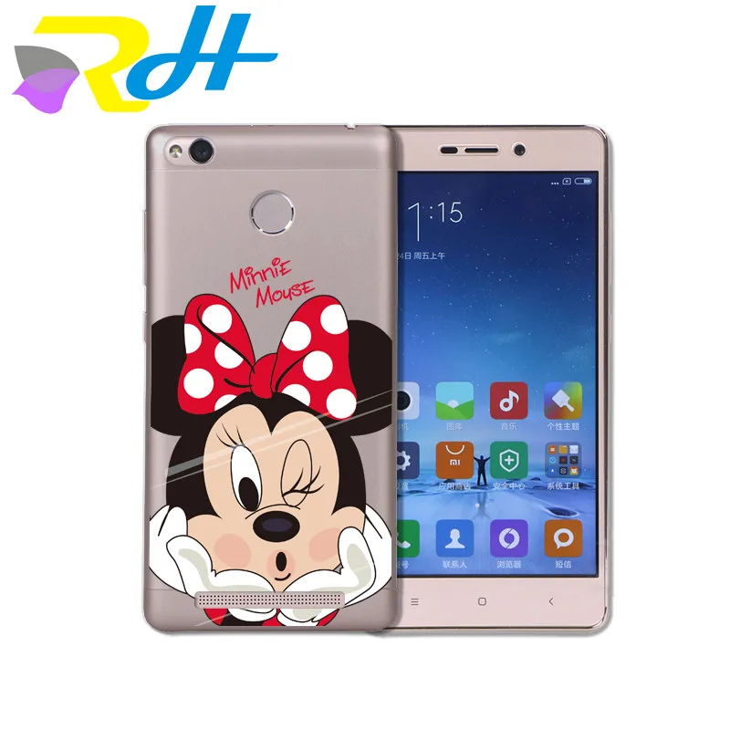 Чехол из ТПУ для Xiaomi Redmi 4A 4X Note 5A Mi 5X 6 Plus чехол с наклейками на рот и поцелуй 4 |
