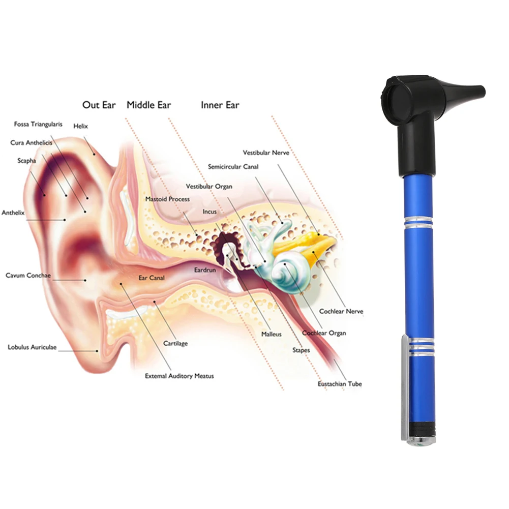 Portable Medical Diagnostic Penlight Otoscope Ear Wax Cleaner Magnifying Lens Care Tool Inspection examination microscop | Красота и