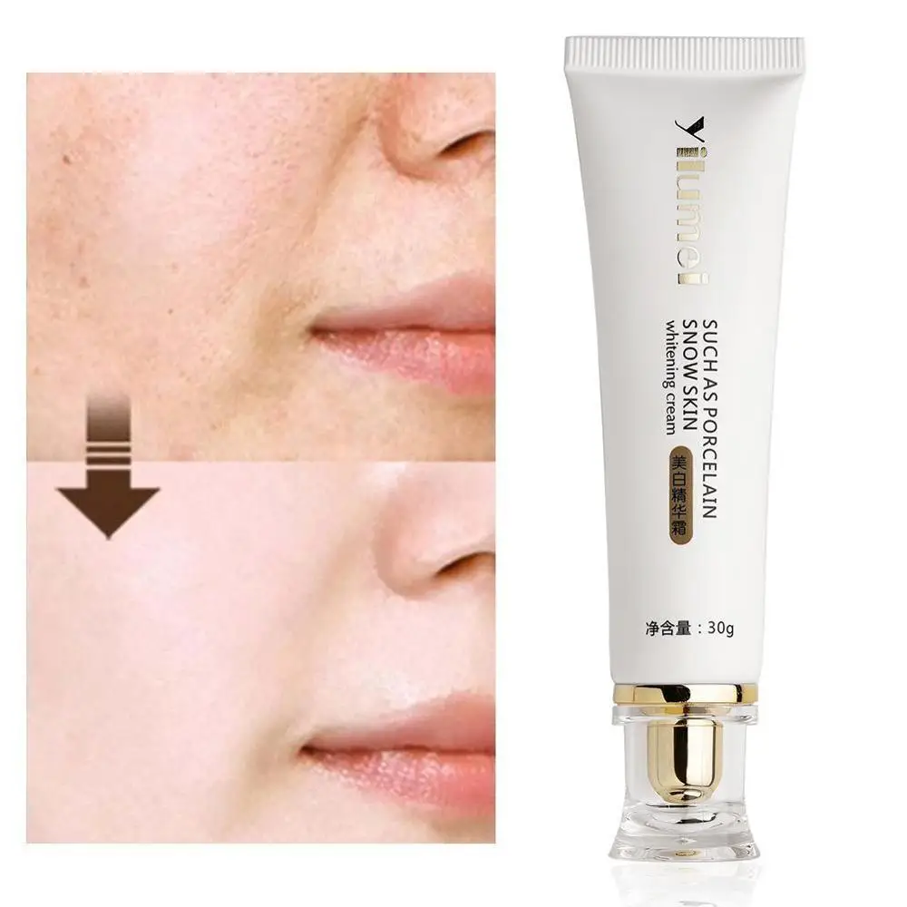 30 мл отбеливающий крем отбеливание кожи весь лосьон для тела ноги коленей личные