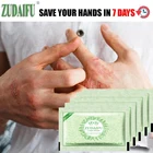 Мазь для тела при псориазе дерматите и экземе зуде 10 шт.лот zudaifu