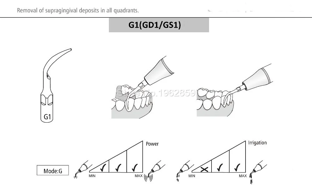 10 шт./лот G1 стоматологический ультразвуковой скалер наконечник масштабирования