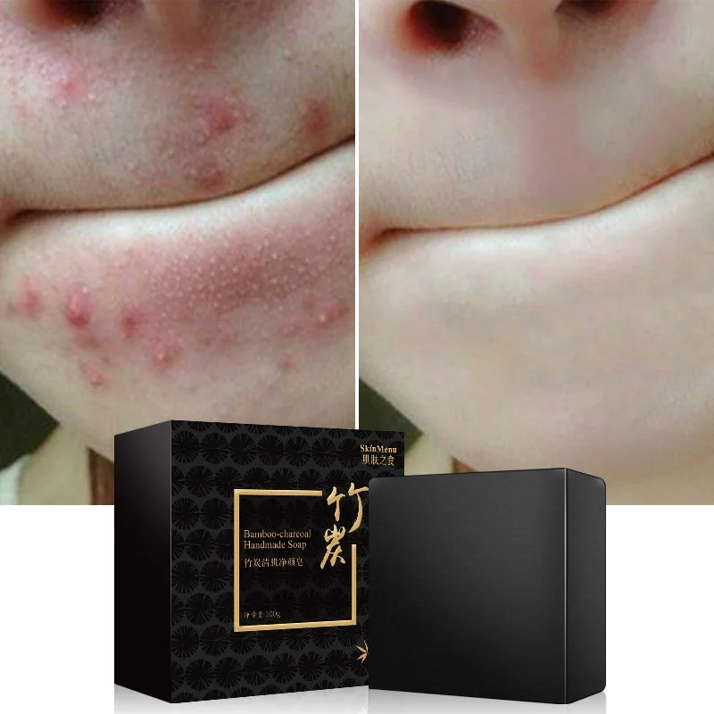 Бамбуковый уголь морская соль лечение акне ручная работа мыло масло контроль