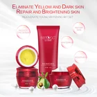 Бесплатная доставка, отбеливающий крем для лица с веснушками, сильный эффект, удаление пигментов меланина, прыщей, темных пятен, набор кремов для лица