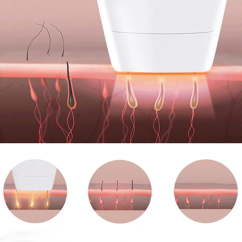 Лазерное Удаление волос IPL домашний фотонный эпилятор для всего тела подмышек
