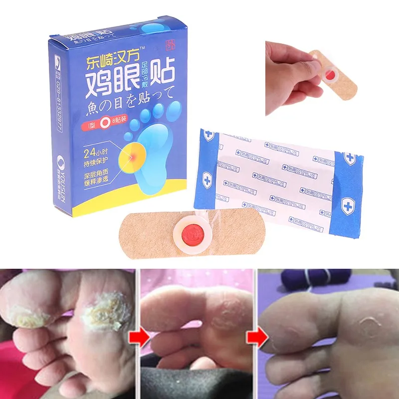 8 шт. отшелушивающие Пластыри для мозолей и бородавок|Инструмент ухода за