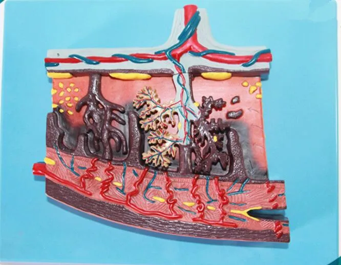 Фото Модель увеличения плацентарной ткани человека модель зума плаценты маточные