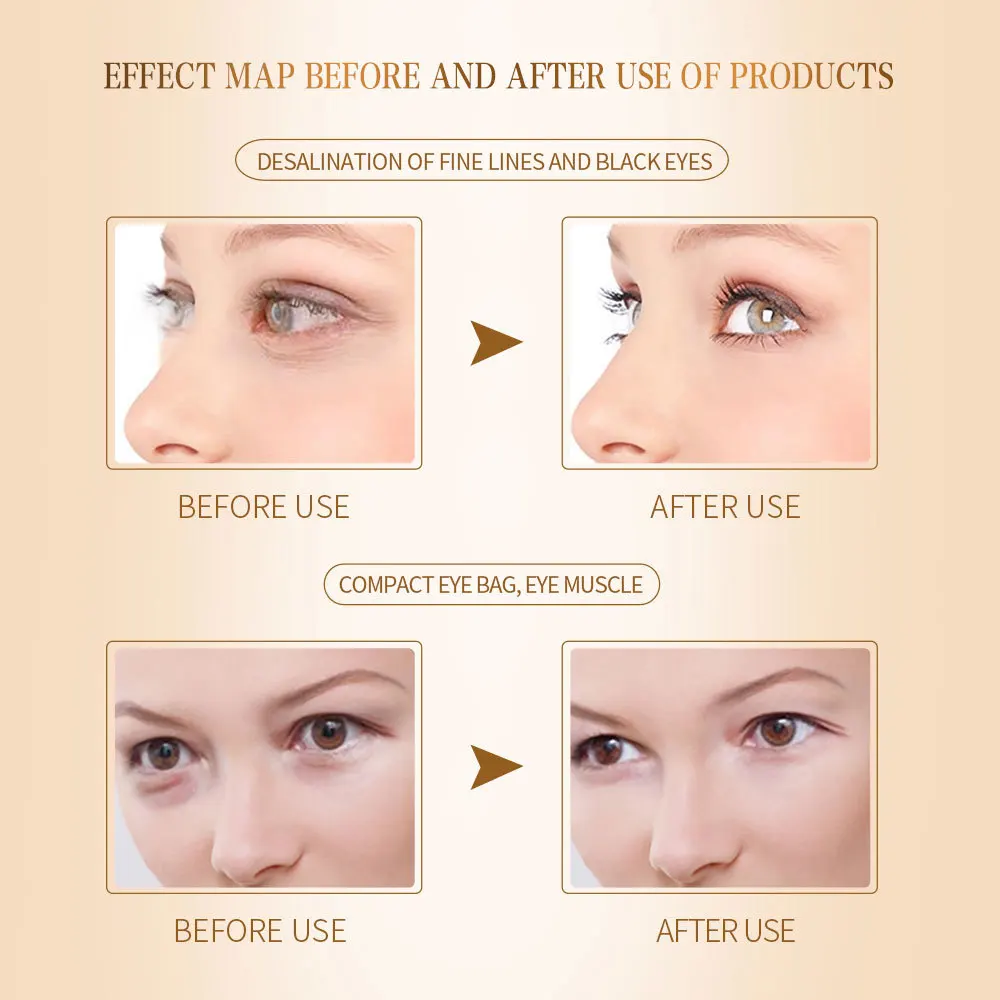 Золотой крем для глаз с темными кругами мешки удаления Oog Creme против старения