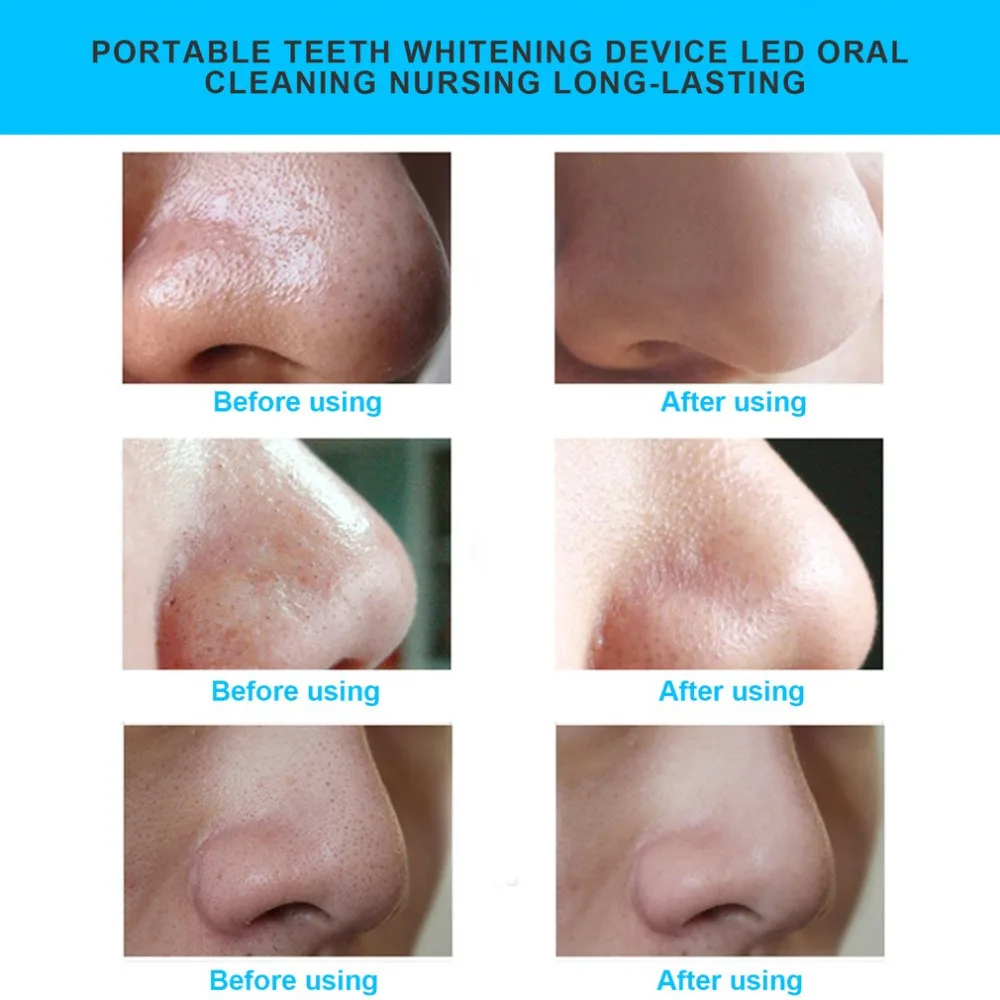 Портативный USB микро светодиодный экран для очищения лица удалитель черных точек